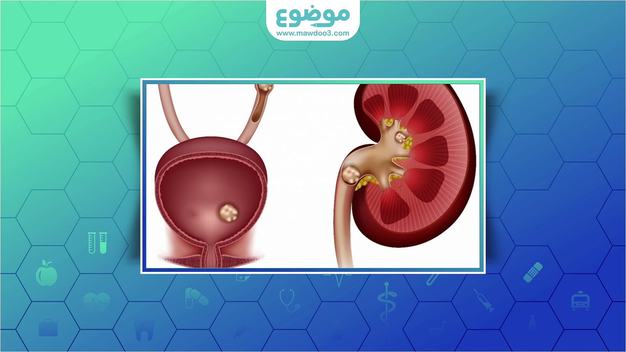 ما هي أعراض التهاب البول