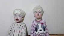 Doğuştan Albino ve İşitme Engelli Kardeşler Yardım Bekliyor