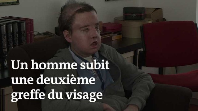 Greffé pour la seconde fois du visage, Jérôme Hamon dit se sentir « très bien »