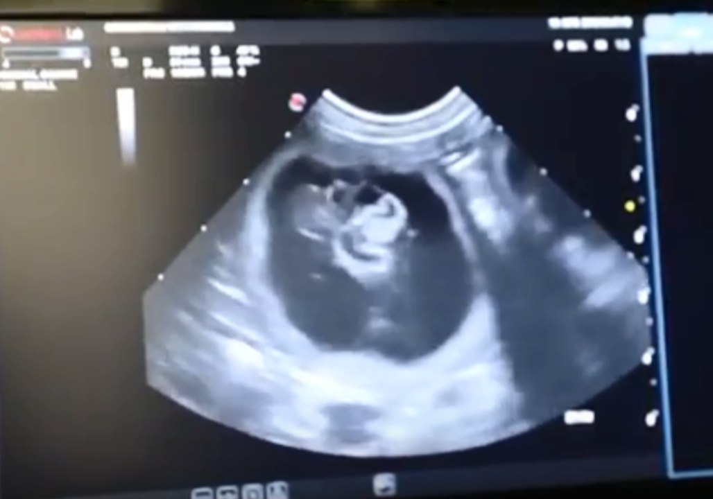 Australian Reptile Park Expecting Dingo Puppies