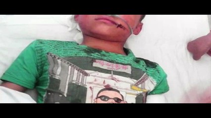 Desquiciada madrastra apuñala a su hijastro sin razón alguna, la policía no hace nada