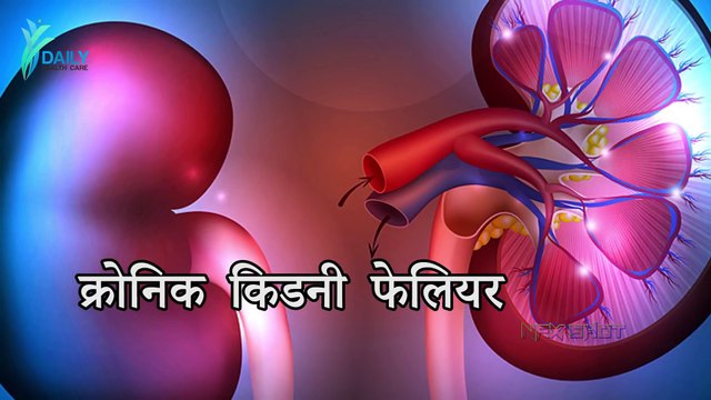 Kidney Failure Signs, Symptoms, Causes and Treatment Daily Health Care