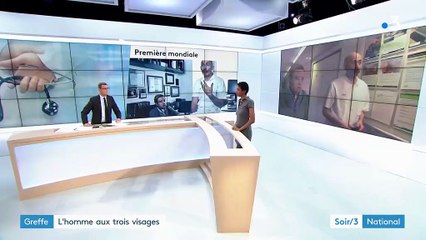 Un homme subit une deuxième greffe de visage pour la première fois