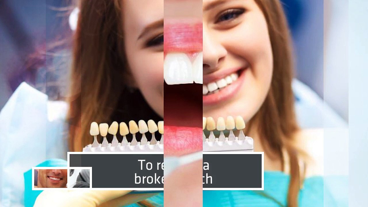 Tooth Replacement Options for Missing Teeth