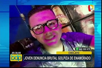 Chiclayo: joven denuncia brutal golpiza por parte de su enamorado