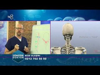 Omurilik kanal darlığı ve tedavileri | Op. Dr. Onur KULAKSIZOĞLU