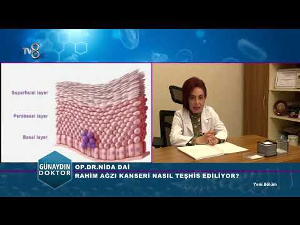 Rahim ağzı kanseri belirtileri ve korunma yolları | Op. Dr. Nida DAİ