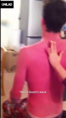 On a tous un pote comme lui qui ne met jamais de crème solaire