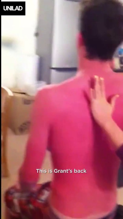 On a tous un pote comme lui qui ne met jamais de crème solaire