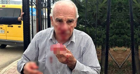 İki Kardeş Kendilerini Uyaran Müdür Yardımcısının Burnunu Kırdı