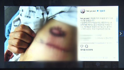 한예슬 "의료사고"...차병원 "회복 지원·보상 논의 중" / YTN