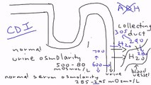 87_Central Diabetes Insipidus