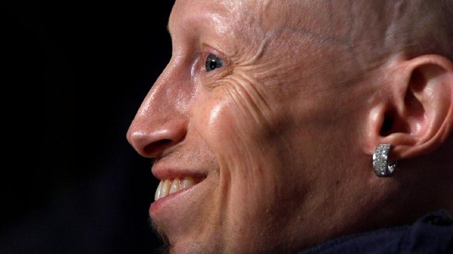 Mini-Me actor Verne Troyer dies at 49