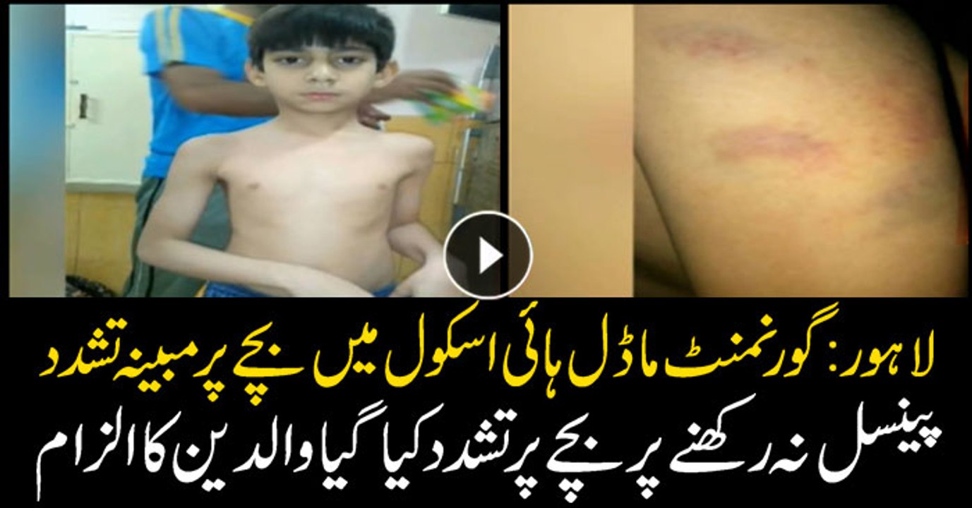 Child beaten mercilessly in Government Model High School for not bringing pencil