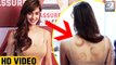 Disha Patani Spotted With Weird Marks On Her Body