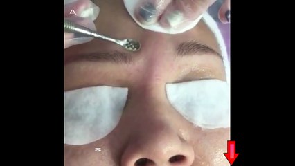 black point removal video girl / retrait du point noir maquillage fille vidéo