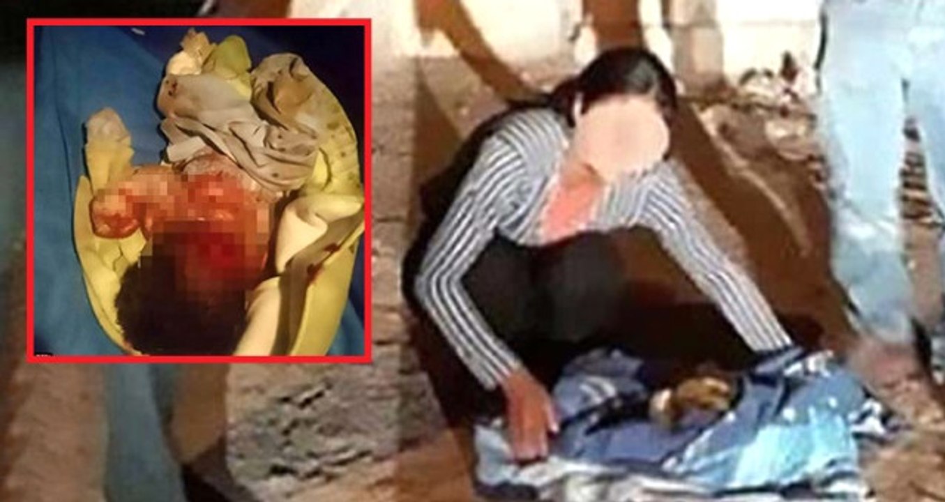 Vicdansız Anne Yeni Doğan Bebeğini Sokağa Bıraktı, Köpekler Her Yerini Parçaladı
