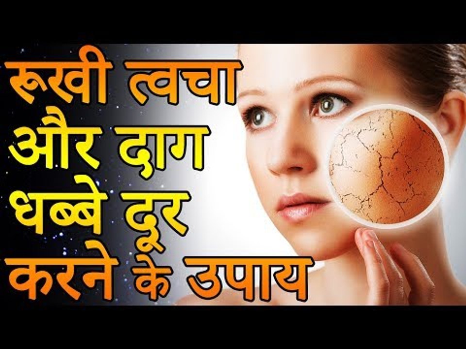 इस घरेलू उपाय से दूर कीजिये चेहरे के दाग धब्बे | रूखी त्वचा और दाग धब्बे दूर करने के उपाय