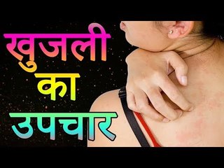 खुजली का उपचार | Itching Problem In Hindi | जानिए खुजली दूर करने का चम्तकारी ईलाज