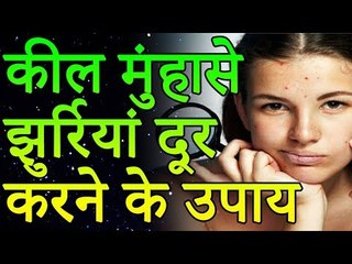रातों रात पिम्पल्स गायब हो जायेंगे | कील, मुंहासे, झुर्रियां दूर करने के उपाय | रोचक जानकारियां