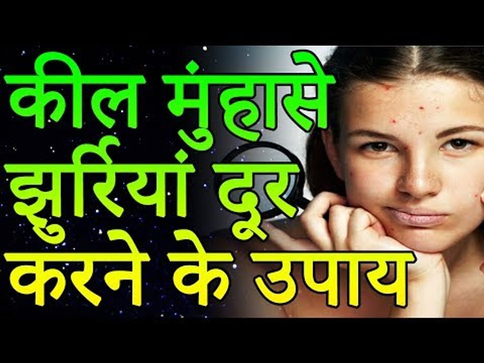 Natural Remedies for Pimples & Skin Problems |...