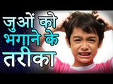 Home Remedies For Head Lice | जूँ भगाने का रामबाण घरेलु नुस्खा | Healthy Remedy