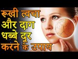 How To Remove Skin Blemishes | चेहरे के दाग धब्बे दूर करने के घरेलू नुस्खे | Healthy Remedy