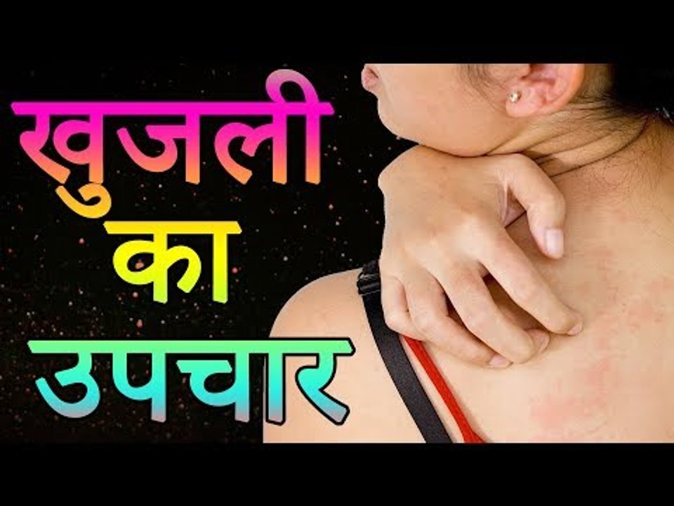 खुजली का बेजोड़ आयुर्वेदिक उपचार | दाद खुजली का रामबाण इलाज | Healthy Remedy