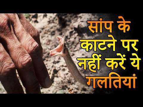 सांप काट ले तो भूलकर भी न करें ये गलति‍यां | Snakes Bites Types Symptoms | Healthy Remedy