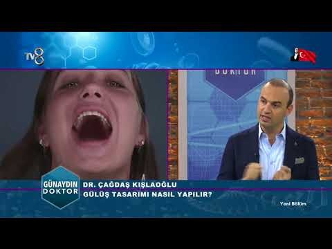 Bilgisayar destekli gülüş tasarımı | Dr. Çağdaş KIŞLAOĞLU