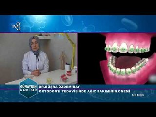 Ortadontik tedavi nedir ve nasıl  uygulanır | Dr. Büşra ÖZDEMİRAY