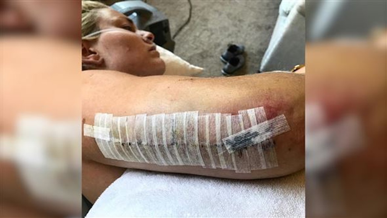 Frau Vonn Ehrgeiz: Lindsey zwischen Schmerz und Gold