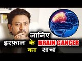 OMG ! क्या Irrfan Khan को है Brain Cancer ?