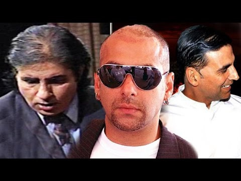 Bollywood's TOP 10 ACTORS Who Underwent Hair Transplant Surgery