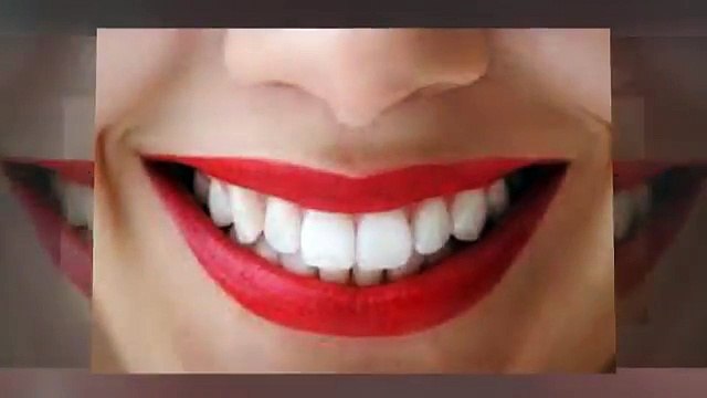 Porcelain Dental Crowns