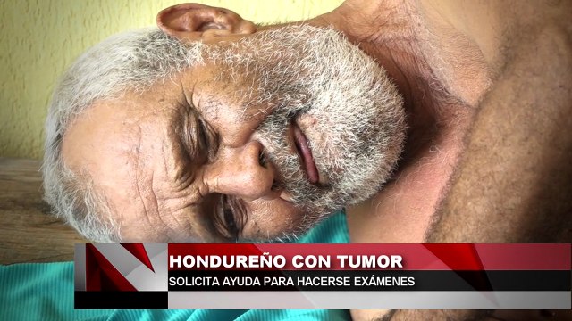 Hondureño solicita ayuda para hacerse examenes.