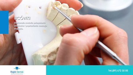 Leczenie ortodontyczne licówki stomatolog Olsztyn Pracownia stomatologiczna Lek.dent. Klaudiusz Rojek