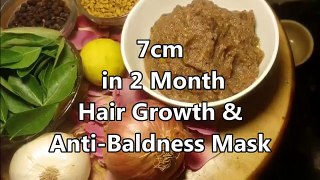 7cm in 2month HAIR GROWTH | काले लम्बे घने बालों के लिए | Stop HAIR LOSS - Baldness Hair Mask