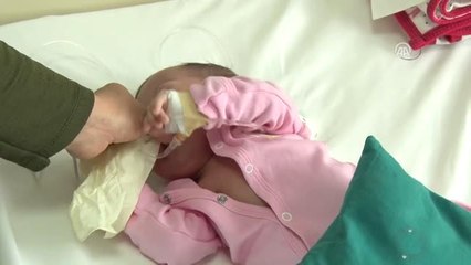 Kayseri'de 3 Aylık Bebeğin Kalbindeki 3 Delik Kapatıldı