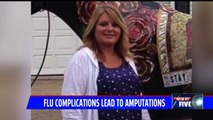 Indiana Woman's Leg Amputated After Flu Complications