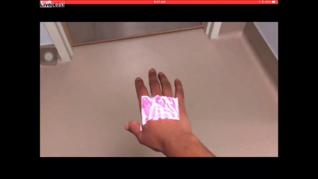 Cet appareil permet de voir vos veines sous la peau