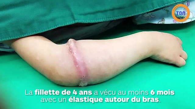Un élastique autour du bras n'est pas toujours une bonne idée