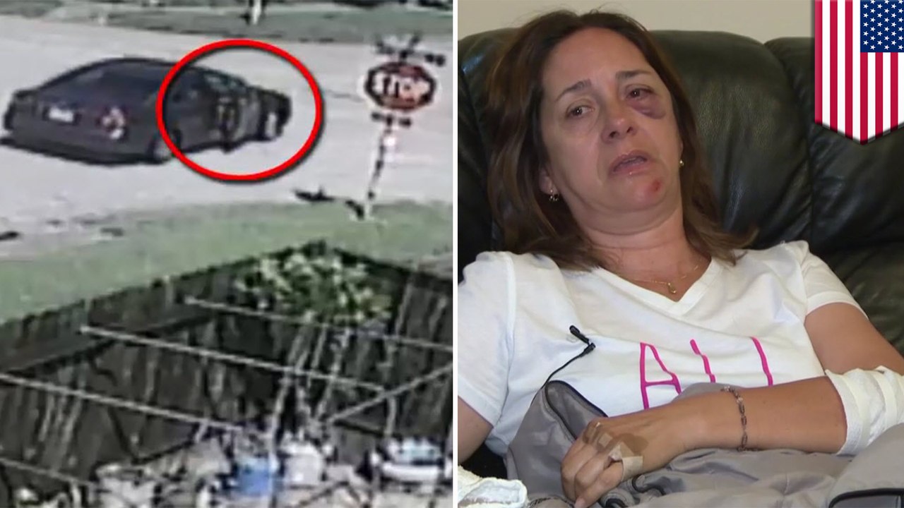 Scientists kept pig brains alive outside body for 36 hours