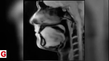 Konuşurken dilimiz nasıl mı hareket ediyor?