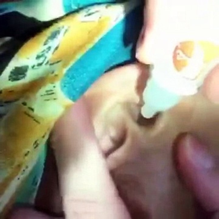 Centipede removed from ear