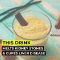 This drink melts kidney stones and cures liver disease. Futusion | DIMIC | Future Vision | BRIGHT SIDE  | BuzzFeedVideo | 5-Minute Crafts | 7-Second Riddles | Natural Cures | Home Remedies for Health | Natural Life Hacks | Natural Ways | Life Hacks |