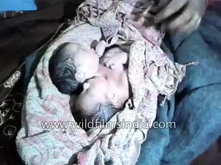 Baby born with two heads in India