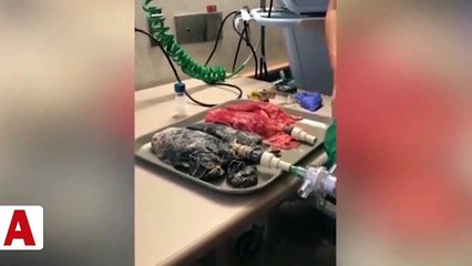 20 yıl sigara içen insanın akciğeri