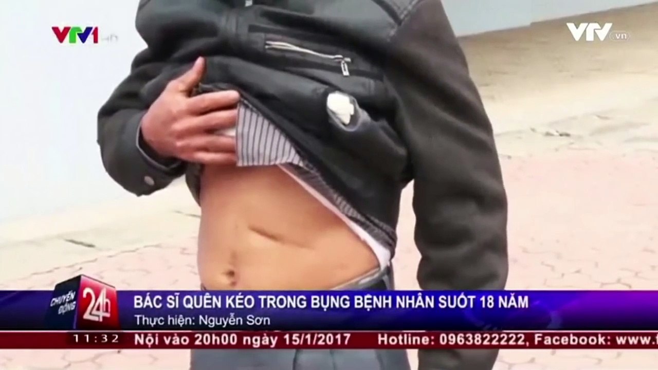 TRPEO JE UŽASNE BOLOVE U STOMAKU PA JE OTIŠAO DA NAPRAVI RENDGEN SNIMAK: Ono što su doktori na njemu videli ih je ZAPREPASTILO!