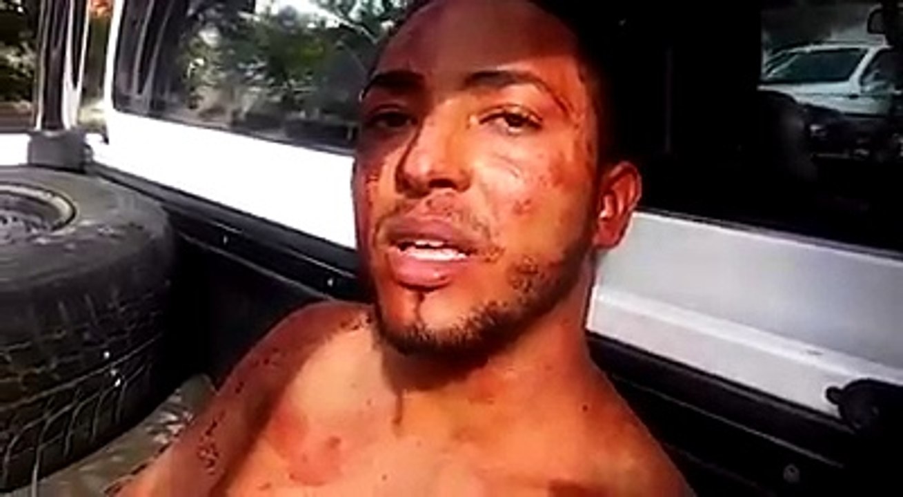 Apresan joven en la calle 10 de Gurabo Stgo. hirió de gravedad sus padres